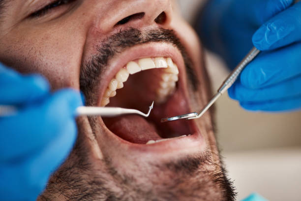 Best Pediatric Emergency Dentist in Winnfield, LA